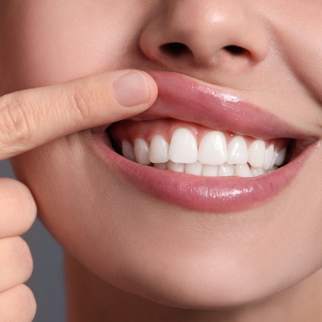 Improve Your Gum Health