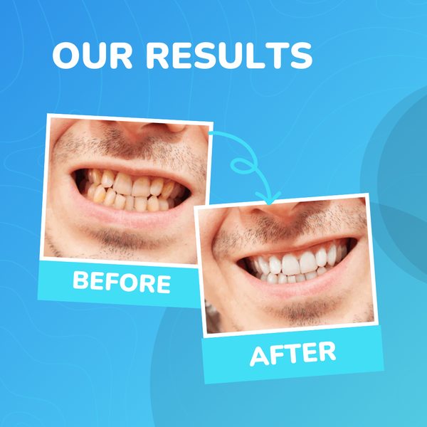 Get That Clean, Confident Smile With Our Water Flosser - 9