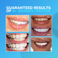 LumiSmile Advanced Teeth Whitening Strips: 8+ Shades Whiter in Just 14 Days (Sold Out) - Thumbnail 2